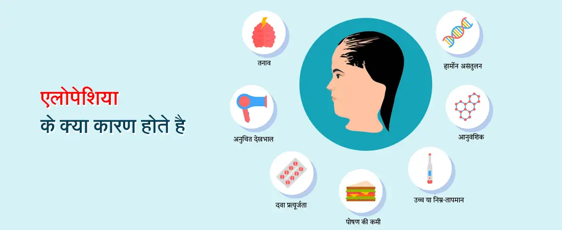 Causes of Alopecia in Hindi